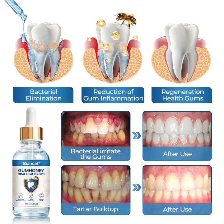 Biancat® GumHoney Oral Repair Drops