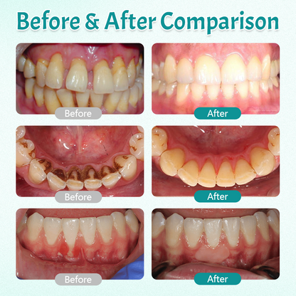 Timilk® HerbTakt Oral Repair Solution