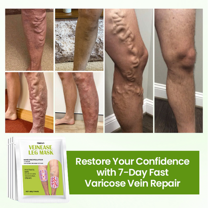 Timilk®VeinEase Leg Mask