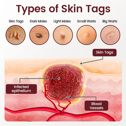 Timilk® BumpAway Gentle Renewal Cream