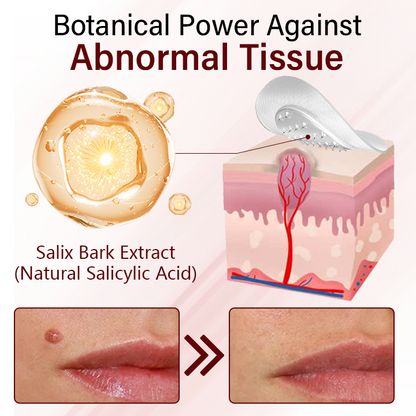 Timilk® Vionara Nano WartErase Patch(CA)