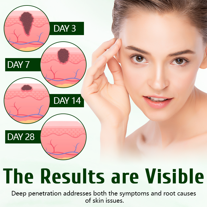 Timilk® DermaPure Tea Tree Healing Cream