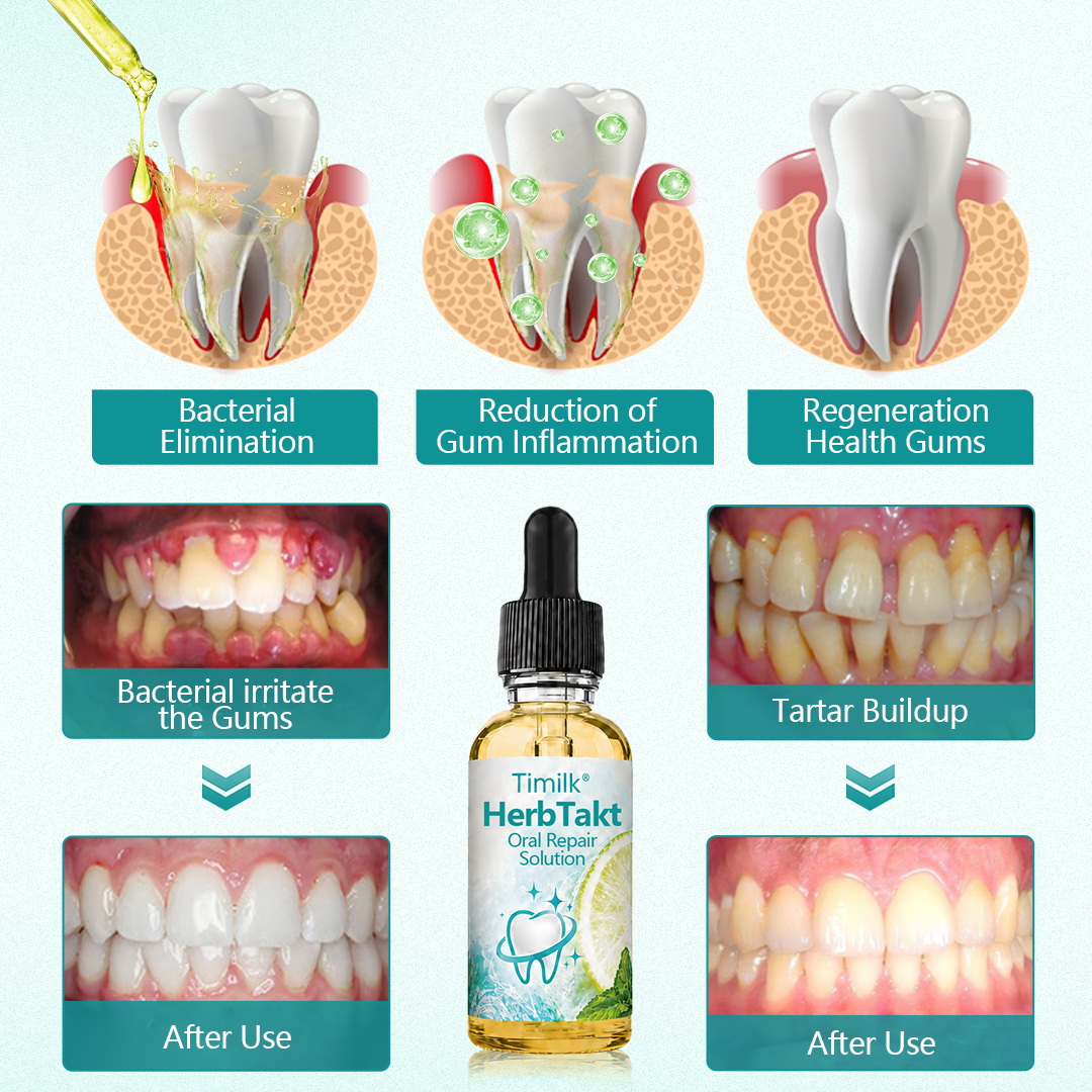 Timilk® HerbTakt Oral Repair Solution