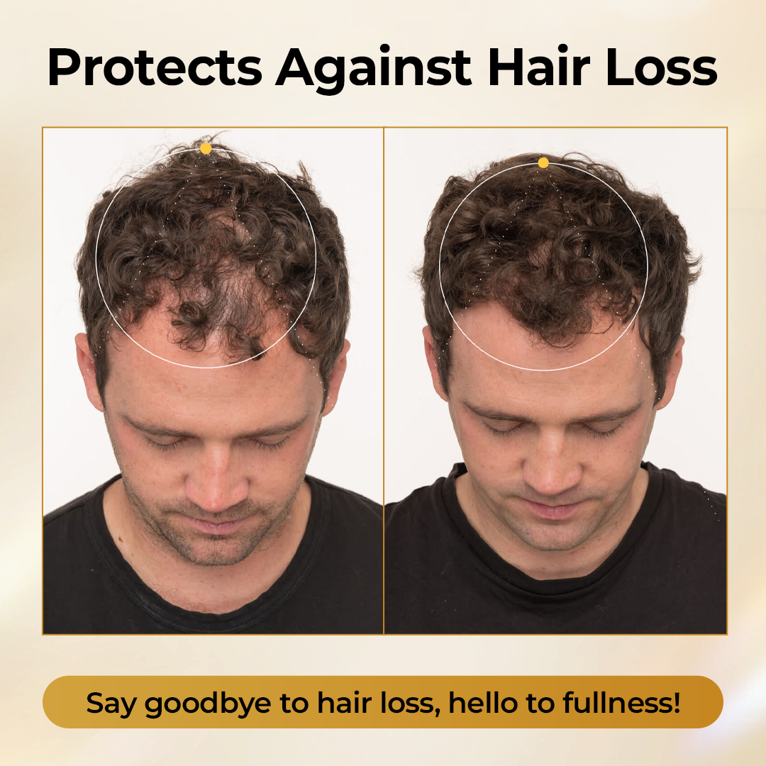 Timilk® CollagenGrow Peptides Hair Growth Spray