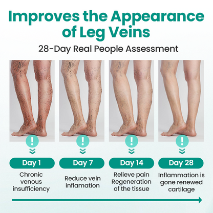 Timilk® LegRenew Varicose Veins Patch✨