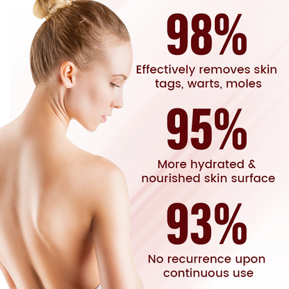 Timilk® Vionara Nano WartErase Patch(CA)