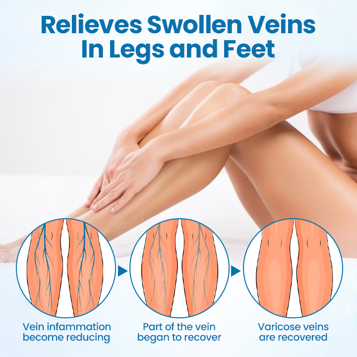 Timilk® VeinGuard Herbal Spray  (new)