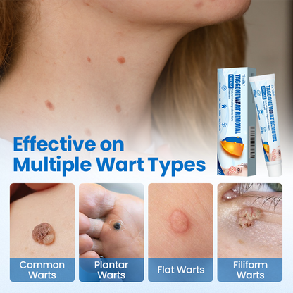 Timilk® TagGone Wart Removal Cream(KA)